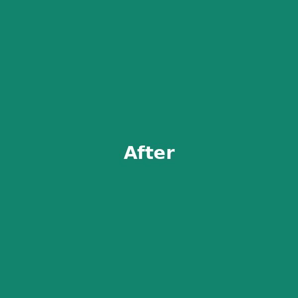 After Smile Makeover