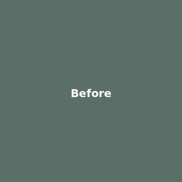 Before Smile Makeover