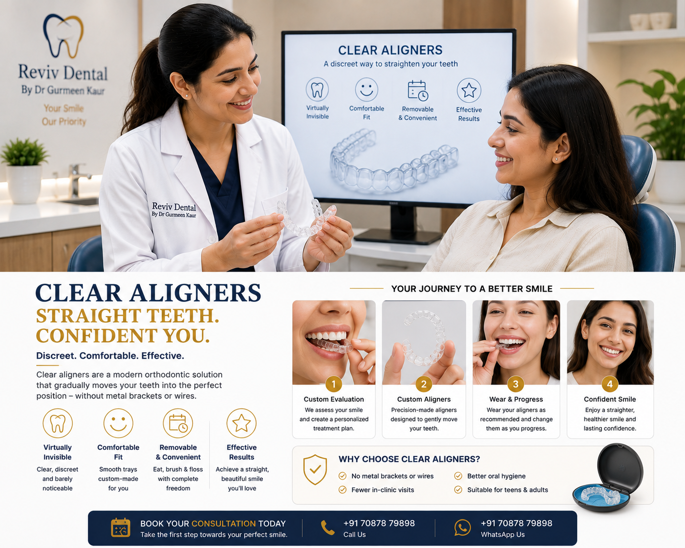Clear Aligners