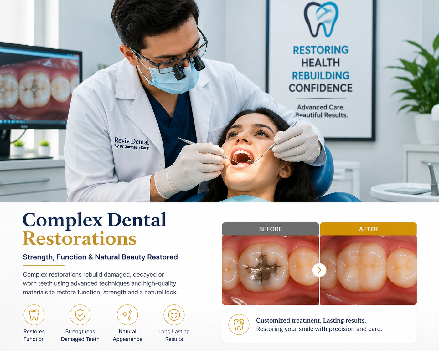 Complex Restorations